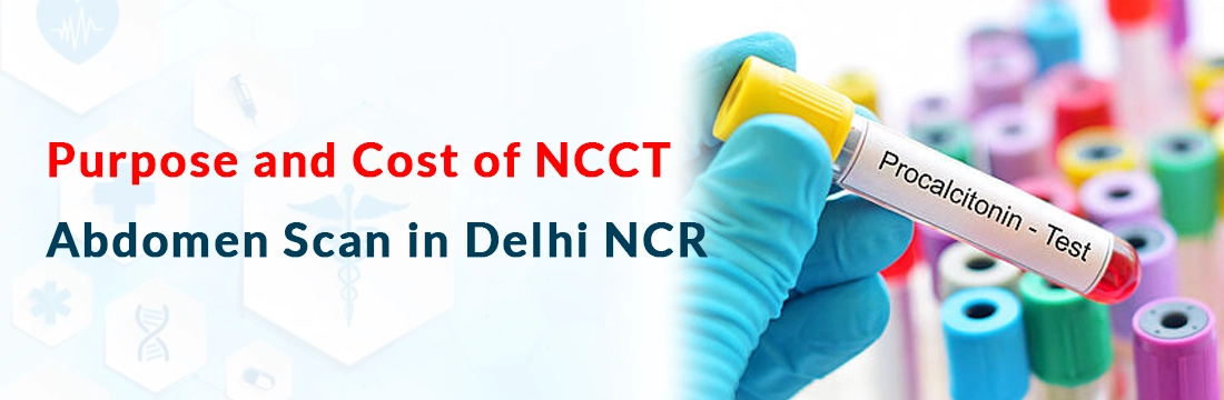 प्रोकैल्सीटोनिन परीक्षण: कीमत, प्रक्रिया, आवश्यकता और तैयारी